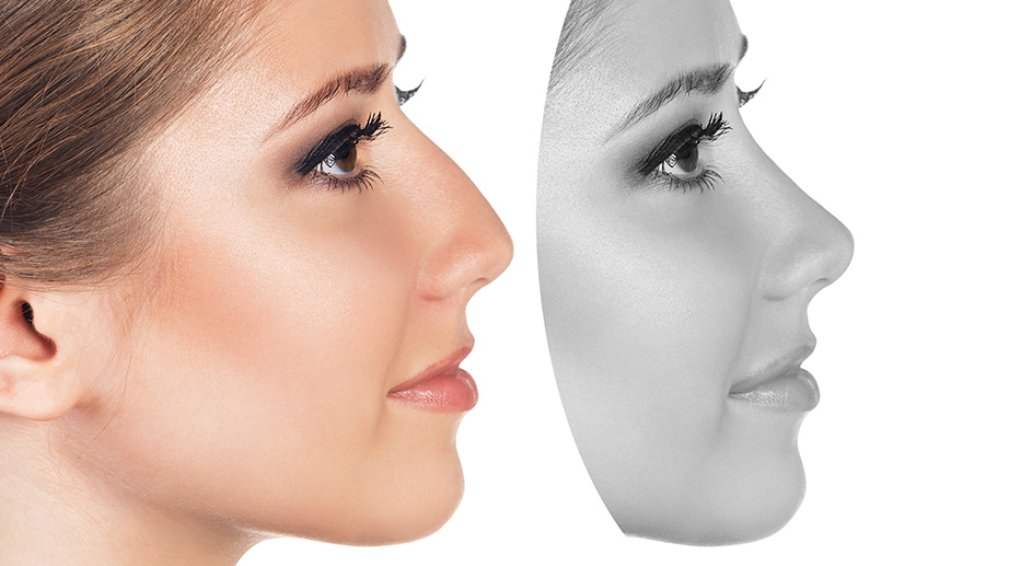 The Art of Rhinoplasty: Achieving Balance and Harmony