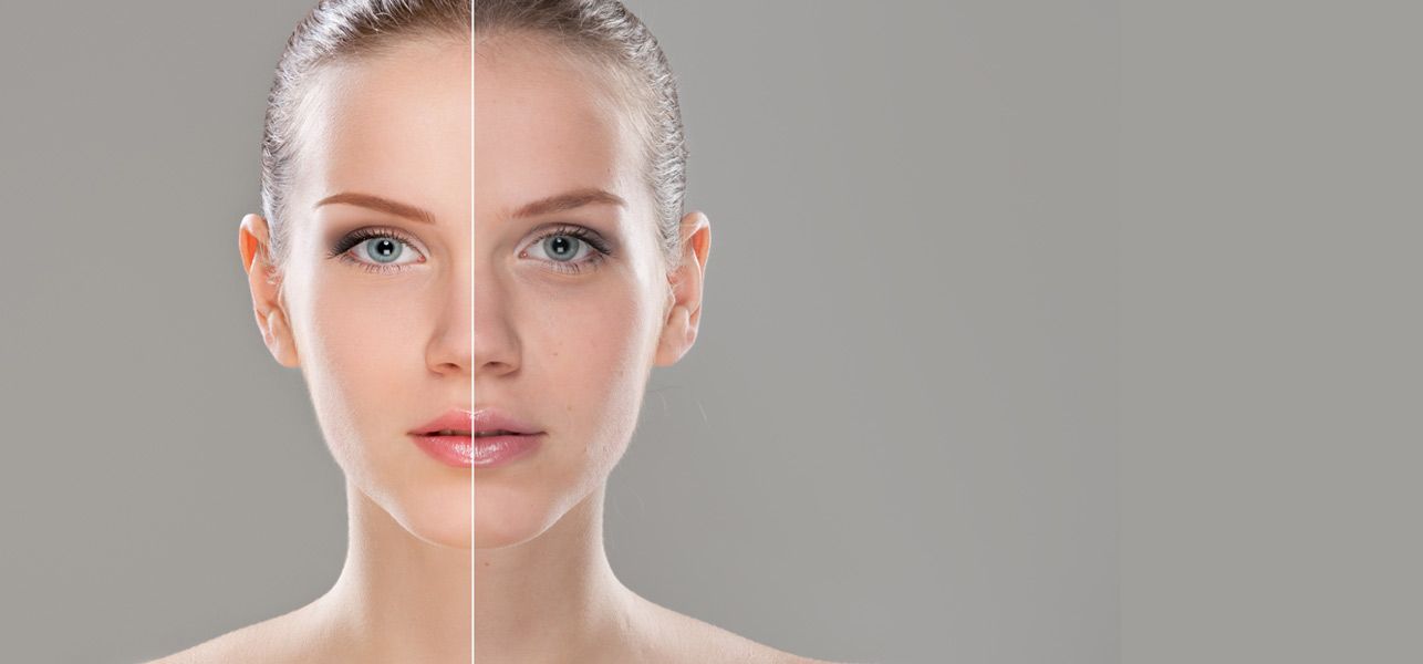 Scar Revision and Skin Rejuvenation: Unlocking Your Skin