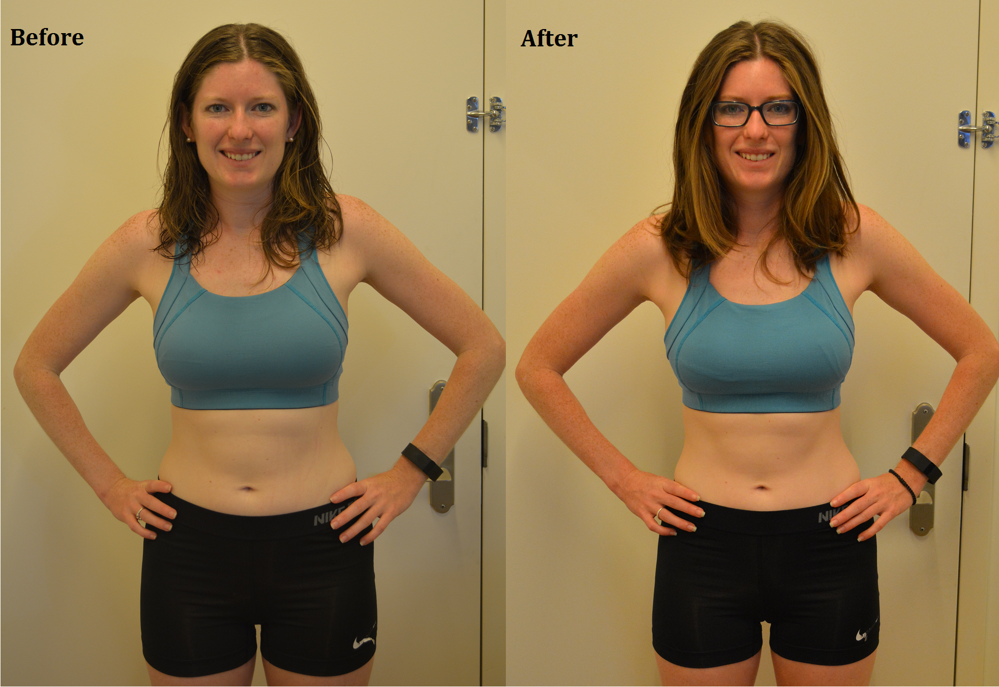 Mommy Makeover: Tips to be Followed Before and After Surgery