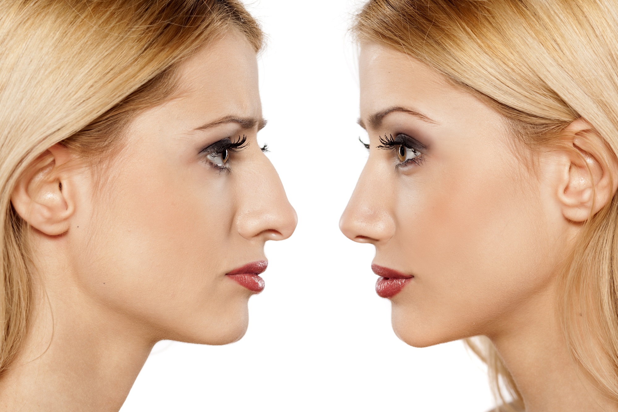 All about Rhinoplasty