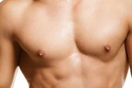 gynecomastia/ male boobs